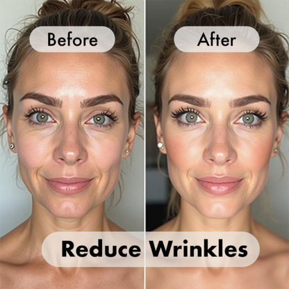 Masque LED Visage en Lumière Rouge — Anti-Âge, Acné et Éclat de Peau