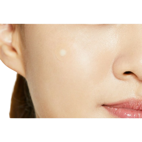 Patchs Anti-Acné Hydrocolloïde — Traitement Local et Rapide des Boutons