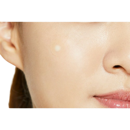 Patchs Anti-Acné Hydrocolloïde — Traitement Local et Rapide des Boutons