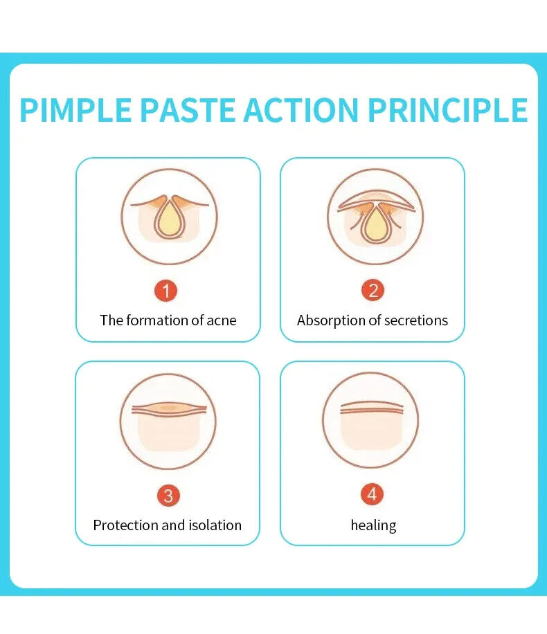 Patchs Anti-Acné Hydrocolloïde — Traitement Local et Rapide des Boutons